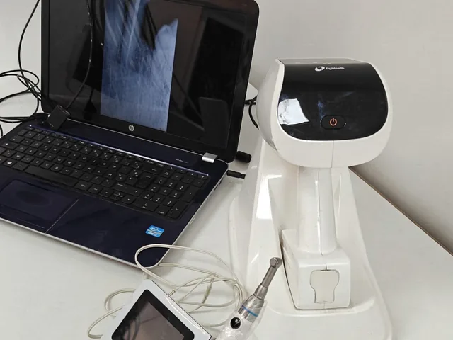 Équipement d'endodontie du cabinet : moteur rotatif et localisateur d'apex