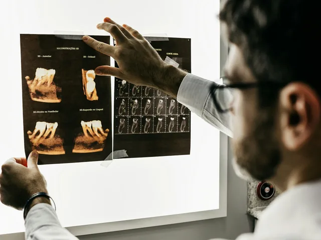 Lecture d'une radiographie panoramique dentaire